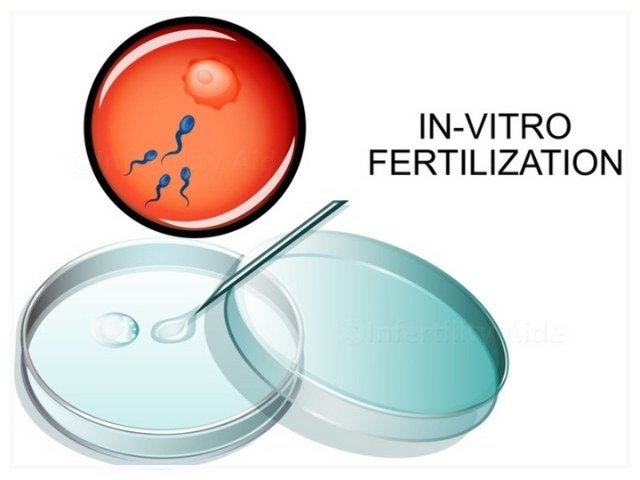 best infertility center in Indore
